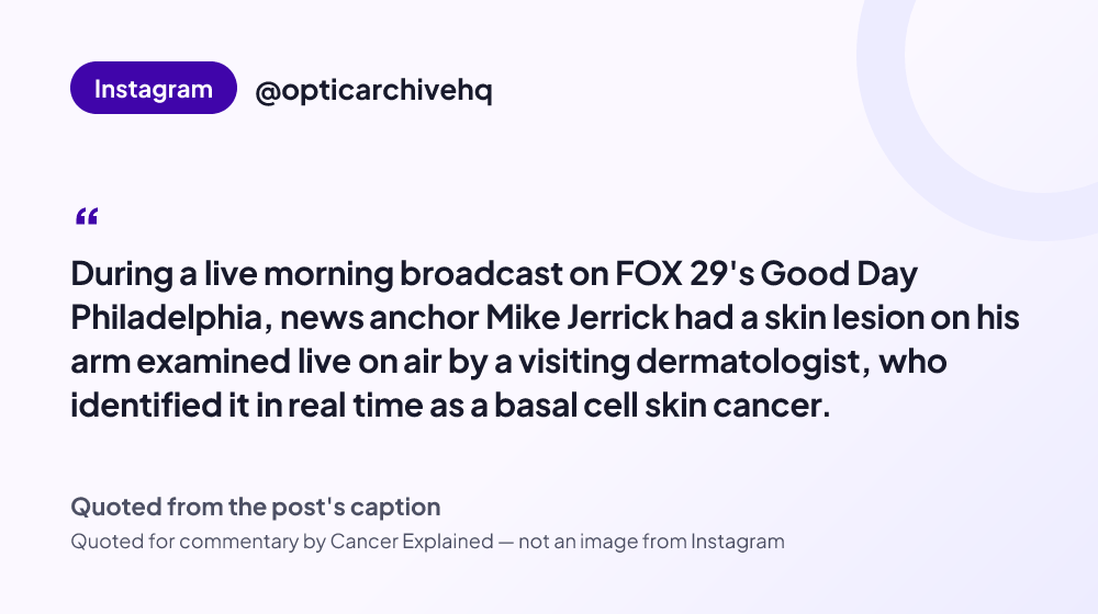 Quote card reading: "During a live morning broadcast on FOX 29's Good Day Philadelphia, news anchor Mike Jerrick had a skin lesion on his arm examined live on air by a visiting dermatologist, who identified it in real ..." — @opticarchivehq