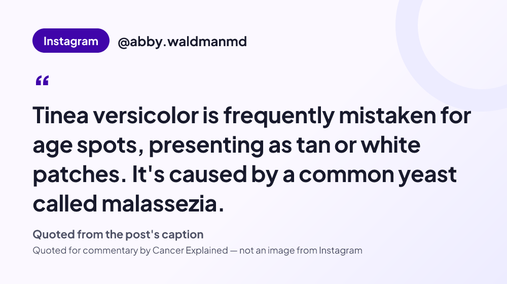 Quote card reading: "Tinea versicolor is frequently mistaken for age spots, presenting as tan or white patches. It's caused by a common yeast called malassezia." — @abby.waldmanmd